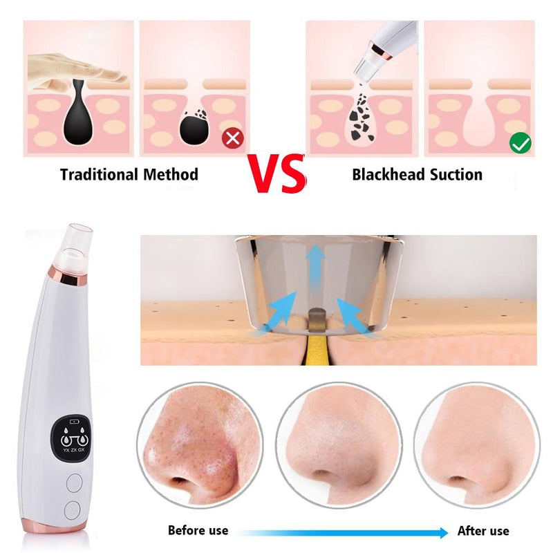 Blackhead Remover Vacuum Pore Cleaner - MakenShop